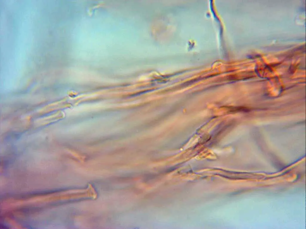 Microscopía de Tectella patellaris - 3 - Subpellis x 1000 con fíbulas